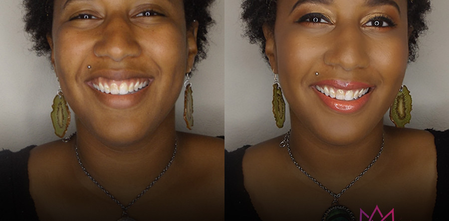 Beauty | Before & After