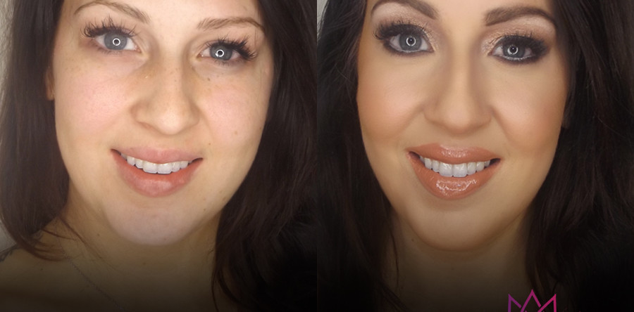 Beauty | Before & After