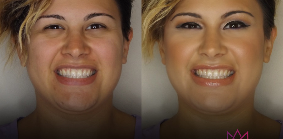 Beauty | Before & After