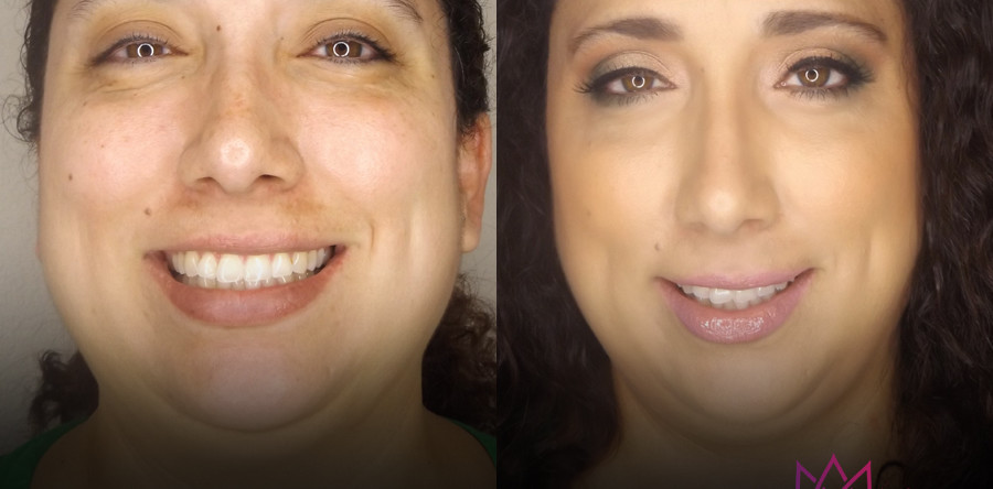 Beauty | Before & After