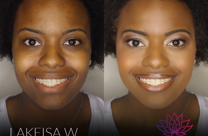 Beauty | Before & After
