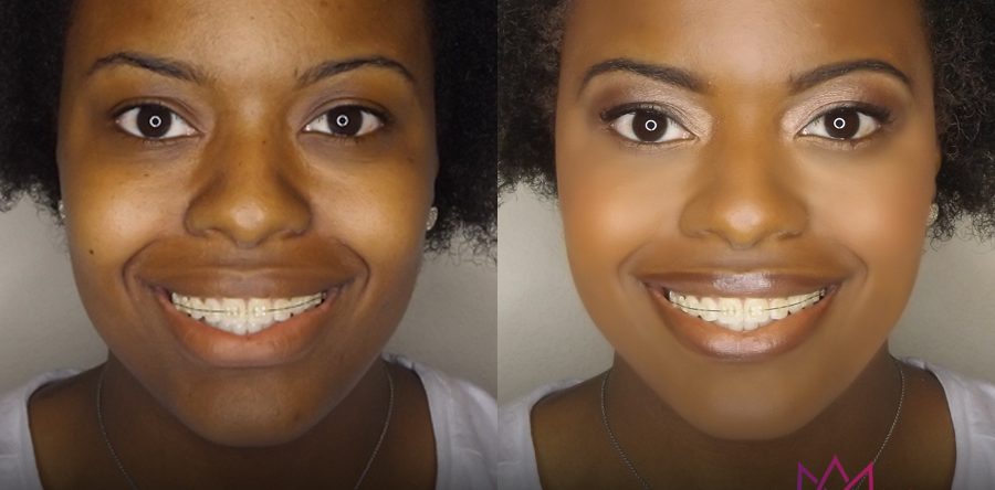 Beauty | Before & After