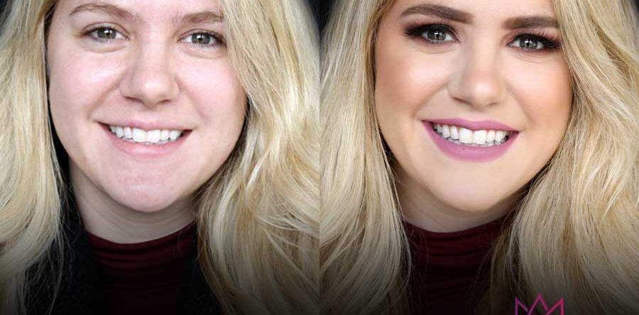 Beauty | Before & After