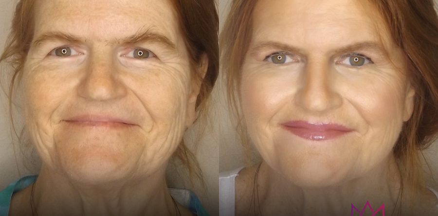 Beauty | Before & After