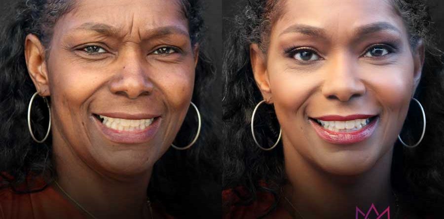 Beauty | Before & After