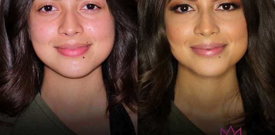 BEAUTY | BEFORE & AFTER