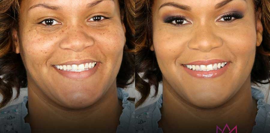 Beauty | Before & After