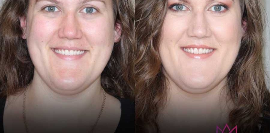 Bridal | Before & After